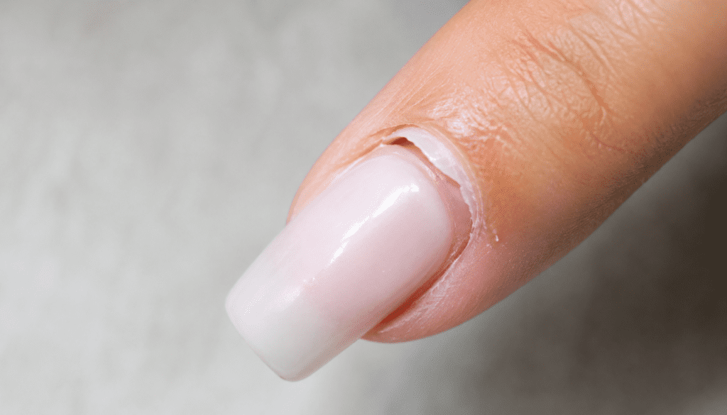 Acrylic nail lifting near the cuticle after a few days
